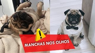 MANCHAS NOS OLHOS DO TU | ATENÇÃO