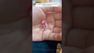 Couple Adopts Baby Squirrel and Raises It with Love #adoption #squirrel #shortsvideo