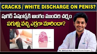 Diabetic Symptoms In Males In Telugu || Penis/Skin Infections In Diabetics || Dr Abhilash Nali