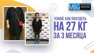 Минус 27 кг за 3 месяца | Отзыв после уменьшения желудка