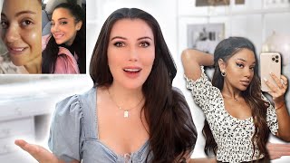 Gabi DeMartino: New Face - Plastic Surgery and My Reaction