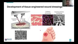 SPP Zürich 2021: Marcin Kotlarz – '3D bioprinting of cell-filled hydrogels for tissue engineering'