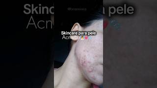 SKINCARE PARA PELE ACNEICA 🧖‍♀️🫧🩷#skincare #acne #short