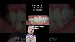 GINGIVITIS AT HOME TREATMENT? #gumdisease #periodontist #gumdisease