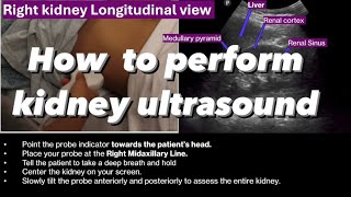 How to perform  kidney ultrasound(Renal ultrasound part I)