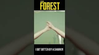 THE FOREST | I GOT BITTEN BY A SHARK!!!