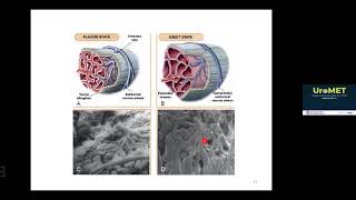 Uromet 6