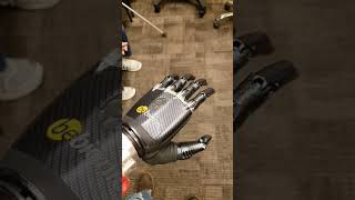 My old BeBionic bionic hand not as good as my new iLimb#bionic #robot #carbonfiber #bionichand #2017