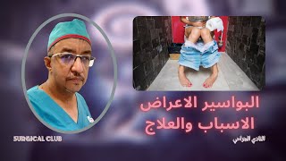 البواسير الاعراض الاسباب والعلاج - وطرق علاجها وطرق إزالة البواسير