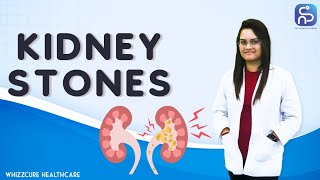 Kidney Stones | Dr. Shubhi Aggarwal