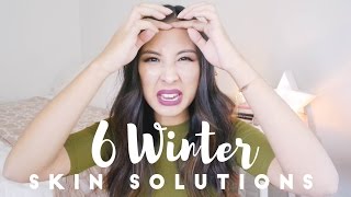 6 DRY/WINTER SKIN PROBLEMS + SOLUTIONS | Dandruff // Dry skin // Humidifier | C&C