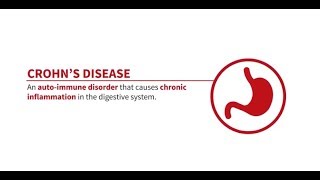 What is Crohn's Disease?