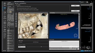 Incorporating STL file into CBCT Diagnosis - HDX WILL E-Learning Series 3th Session