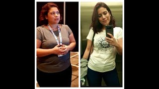 Lose 20 kg in Turkey with bariatric surgery