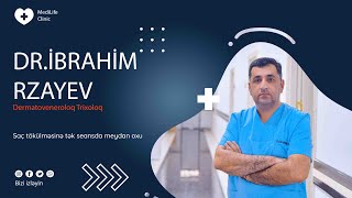 Dr İbrahim Rzayev - ANDROGENETİK ALOPESİYALARIN MÜALİCƏSİNDƏ YENİLİK