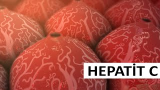 Daşıyıcı hepatit sağalırmı? - Hepatit C xəstəliyi