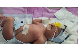 new born so small preterm baby come but baby is so active cleaning done with baby oil thank ❣️