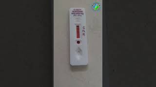 Malaria rapid diagnostic test | Malaria antigen test | Maleria test | plasmodium vivax | P Vivax |MP