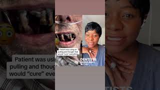 Omg 😨 #viral #youtube #smile #explorepage #teeth #shortvideo #dentalcare