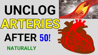 Top 9 Foods To Unclogged Blocked Arteries & Prevent Heart Attack After 50 (Always Eat them)