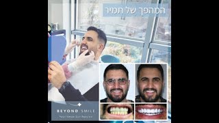 טיפולי שיניים בטורקיה - ביונד סמייל - תמיר שרעבי