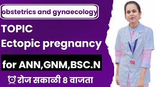 Ectopic pregnancy|obstetrics and gynaecology|by Prerna mam