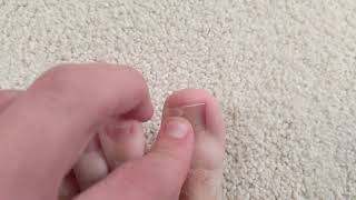 toenail 16