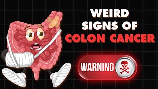 Colon Cancer-Doctor explains Weird Signs