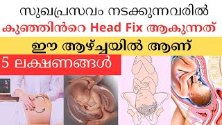 സുഖപ്രസവം നടക്കുന്നവരിൽ കുഞ്ഞിൻ്റെ Head Fix ആകുന്നത് / Normal Delivery symptoms/ Pregnancy Malayalam