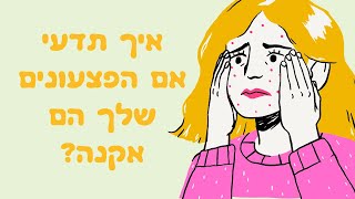 איך אני יודעת אם הפצעונים שלי הם אקנה