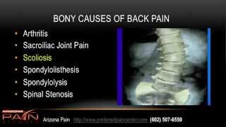 Simple Overview of Acute and Chronic Back Pain Causes