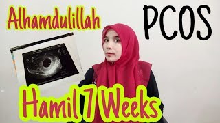 PCOS - Alhamdulillah - Hamil Lagi (7 Weeks 5 Days)