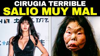 20 FAMOSOS Antes y Después De La Cirugía Plástica