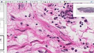 Medical School Histology. Images of Connective Tissue Proper.