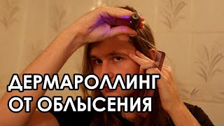 ДЕРМАРОЛЛИНГ ОТ ОБЛЫСЕНИЯ | ЧТО ДЕЛАТЬ ЕСЛИ ЛЫСЕЕШЬ