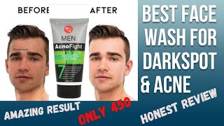 rivaj UK men  acno fight face wash / best face wash for acne / best face wash for boy's / #facewash