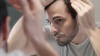 How to Stop Hair Loss In Men and Women? - #Short