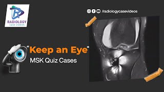 Keep an eye MSK Quiz case