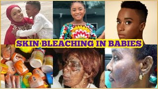 African Mothers bleaching their Babies + Wizkid’s Baby boy bleaching???