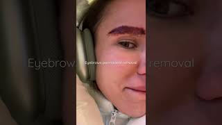 EYEBROWS PERMANENT REMOVAL