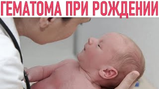 ГЕМАТОМА НА ГОЛОВЕ У НОВВОРОЖДЕННОГО | Опасна ли кефалогематома