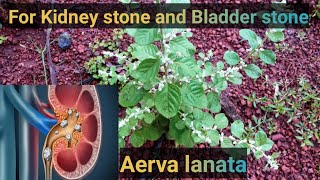 Use 21 days for kidney stone and gall bladder stone