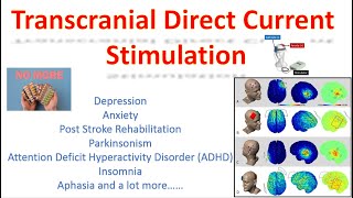 Transcranial Stimulation