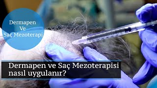 Dermapen ve Saç Mezoterapisi