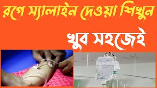 খুব সহজেই রগে স্যালাইন দেওয়া শিখুন। আমি যে ভাবে রগে স্যালাইন পুশ করি।স্যালাইন কি ভাবে দিতে হয়।