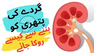 How to prevent kidney stones_Home Remedies_What causes kidney stones?|Dr. Umair Rph #kidneystone