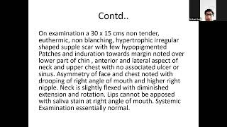 Case Presentation - Post Burn Contracture (09.08.23)