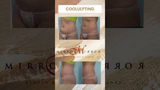 Eliminate stubborn fat with Houston's top #coolsculpting practice