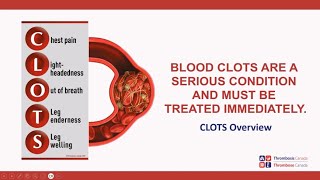 CLOTS Overview