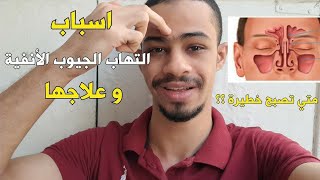 علاج الجيوب الأنفية بالأدوية و اسباب التهابها | متي تحتاج مضاد حيوي و متي تكتفي بعلاج الأعراض فقط !